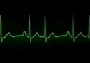 EKG RİTİMLERİ (genel)